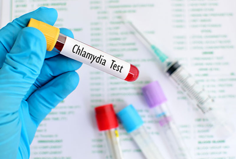 Diagnosis and Treatment of Chlamydia
