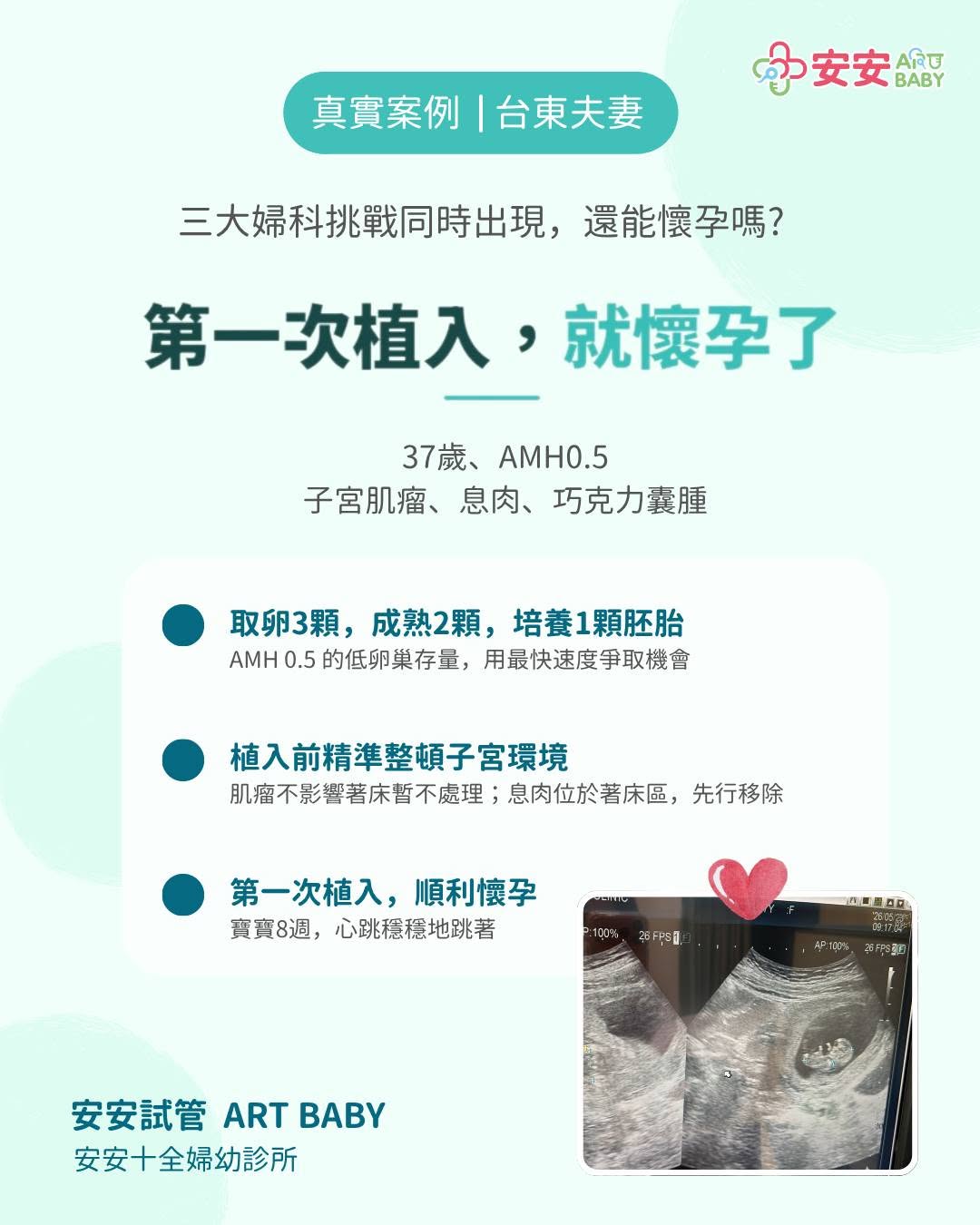 子宮內膜異位症、肌瘤、息肉—— 三個挑戰同時出現，還能在第一次植入就懷孕？